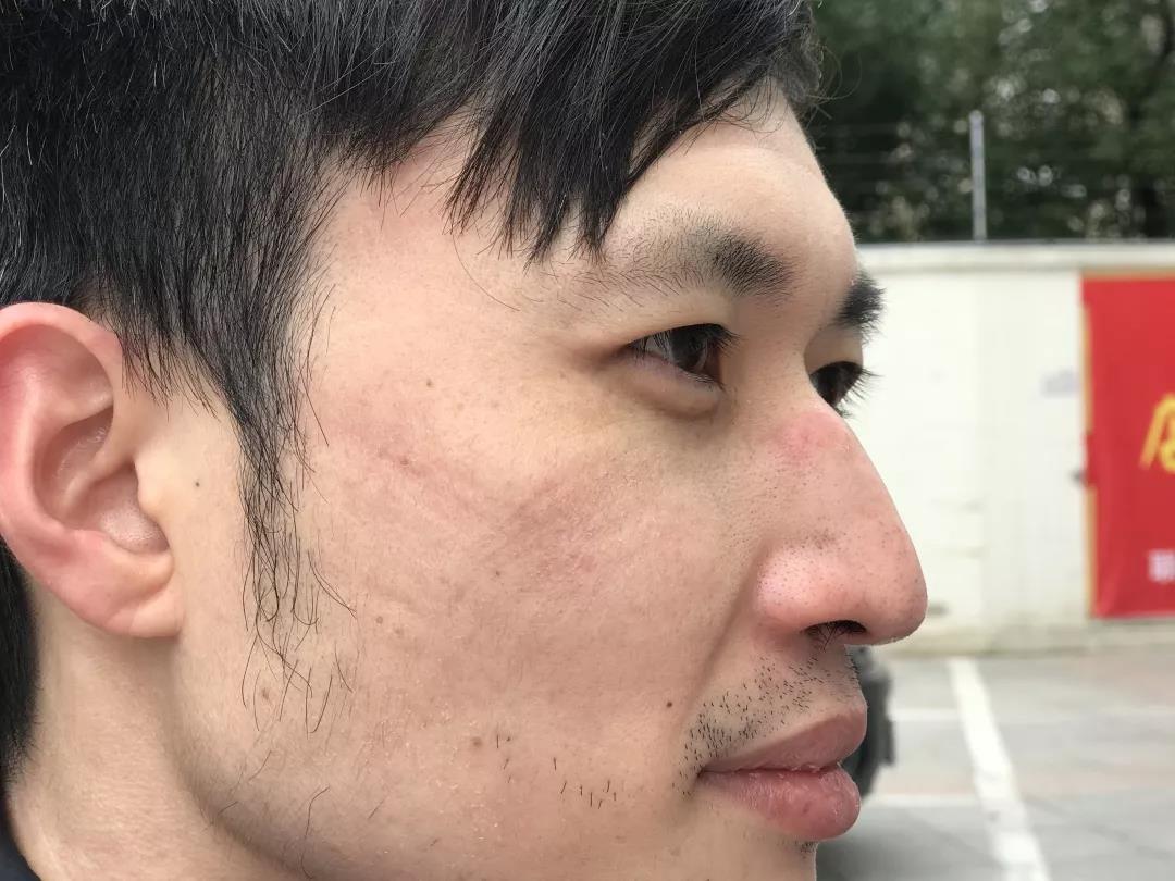 自动转存图片